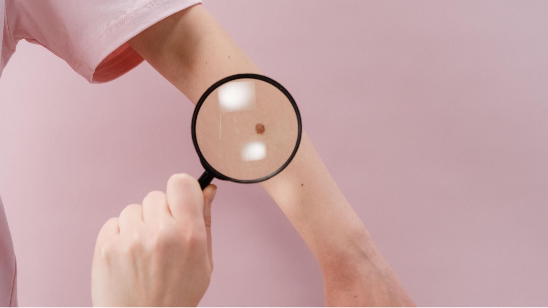 Magnifying glass spotting a mole or melanoma on a woman's arm