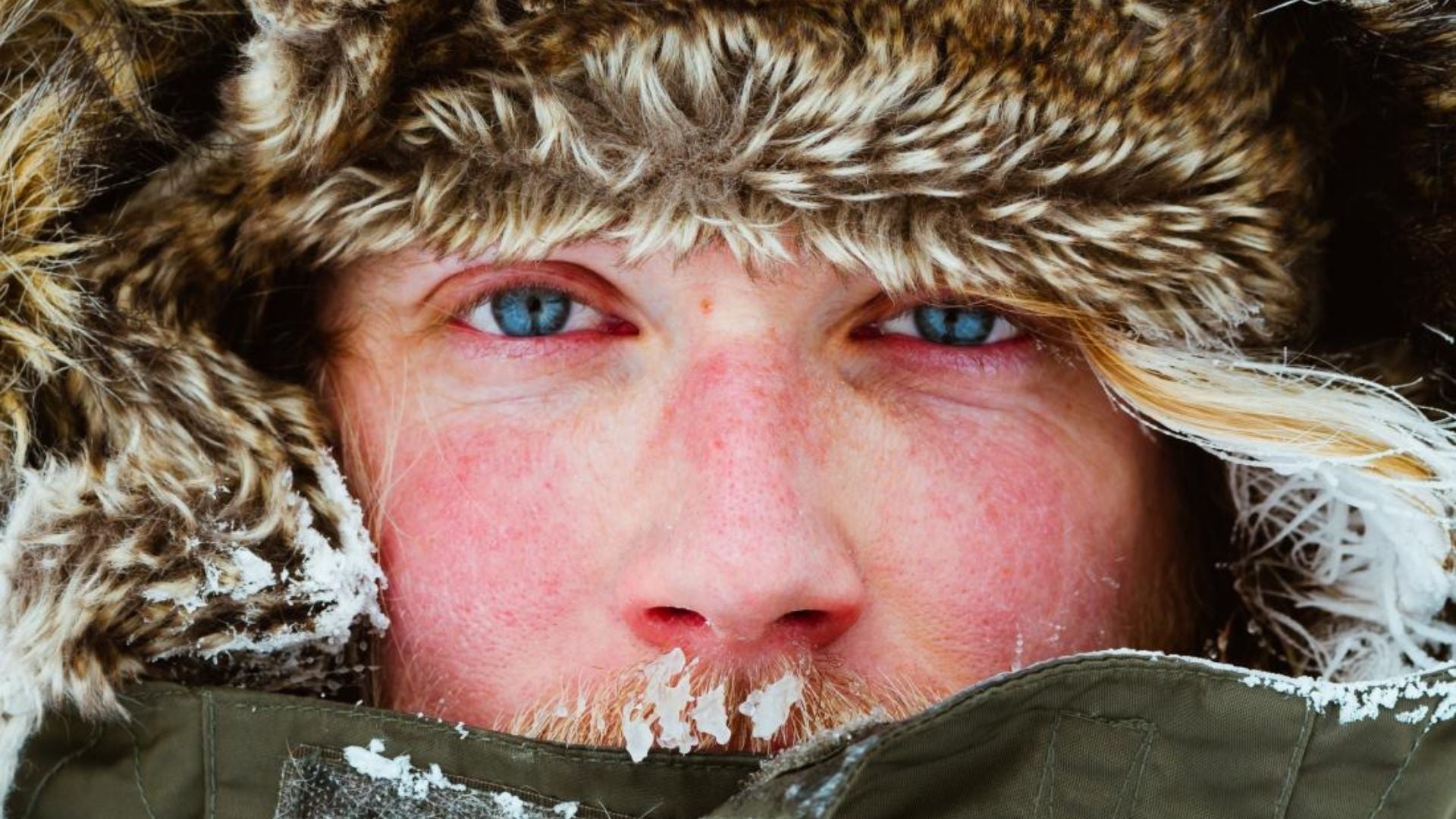 A man in the snow with a windburn face