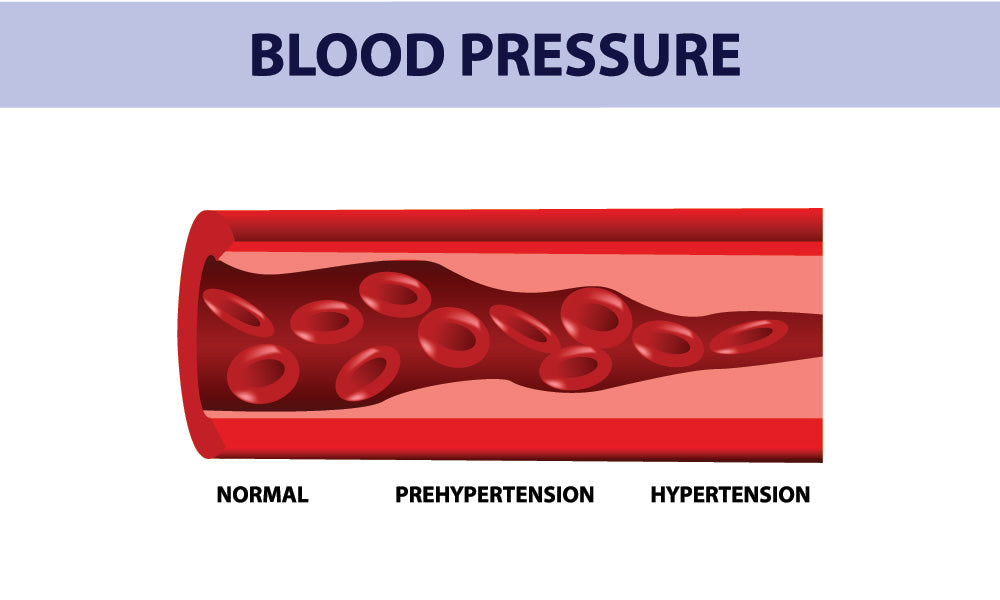 Blood pressure diagram