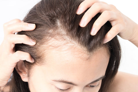 What hair loss treatments are available for women? | ASPS