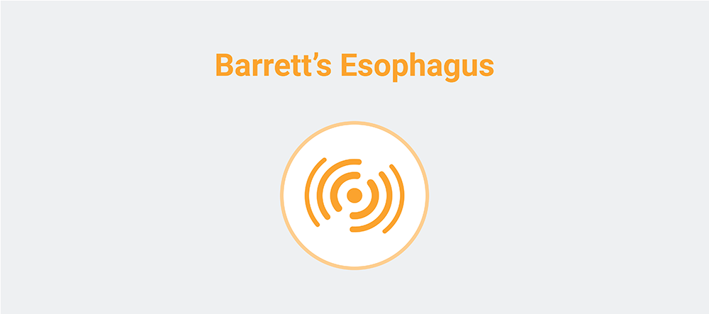 Barrett's Esophagus