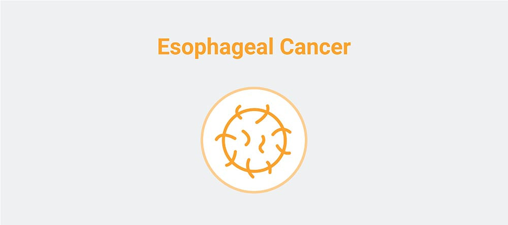 Esophageal Cancer