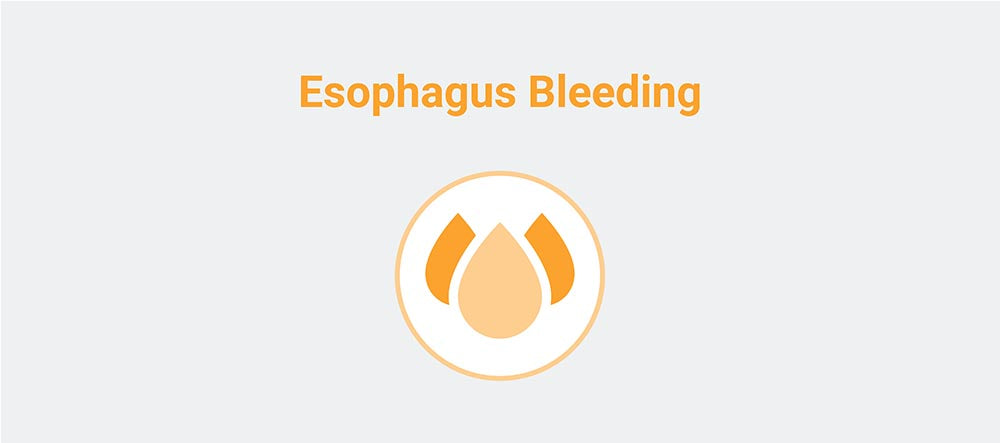 Esophagus Bleeding