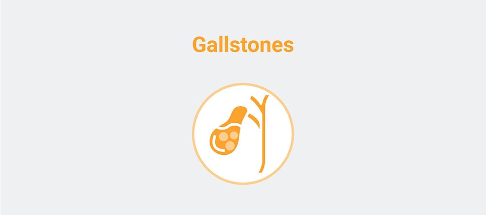 Gallstones