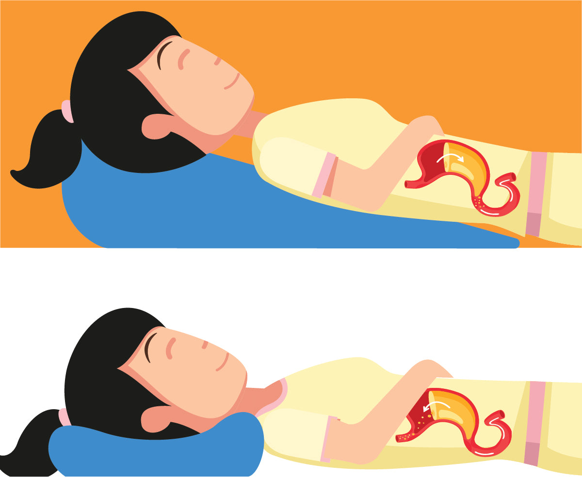 back sleeping for reflux infographic