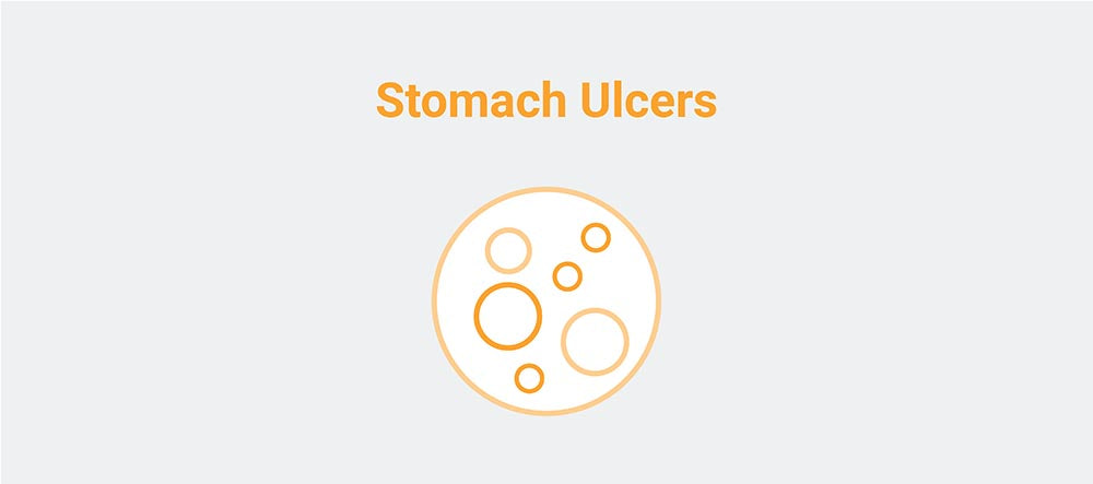 Stomach ulcers