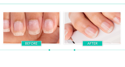 Healthy Nails after using Bellasonic Electric Nail File System