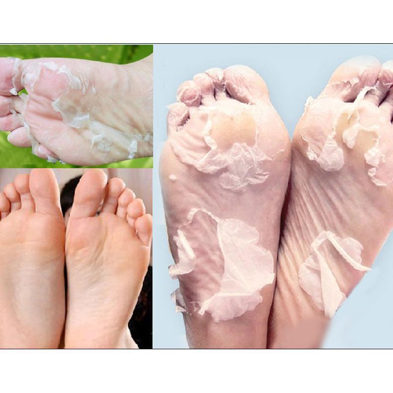 Baby Foot Exfoliant Foot Peel – Techizio