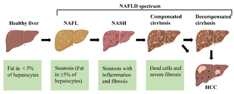 liver condition