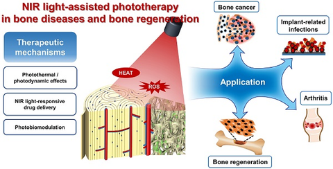 NIR light-assisted phototherapy in bone diseases and bone regeneration