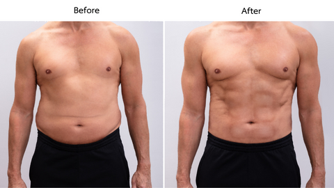 Red Light Therapy weight loss before and after treatment