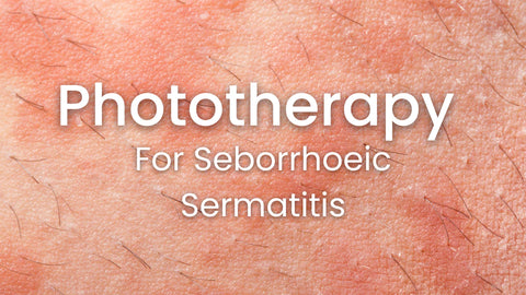 phototherapy for seborrheic dermatitis