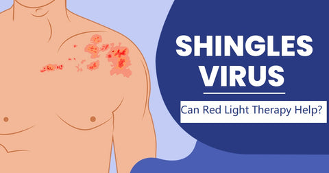 red light therapy for shingles