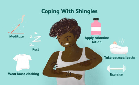 how to treat shingles