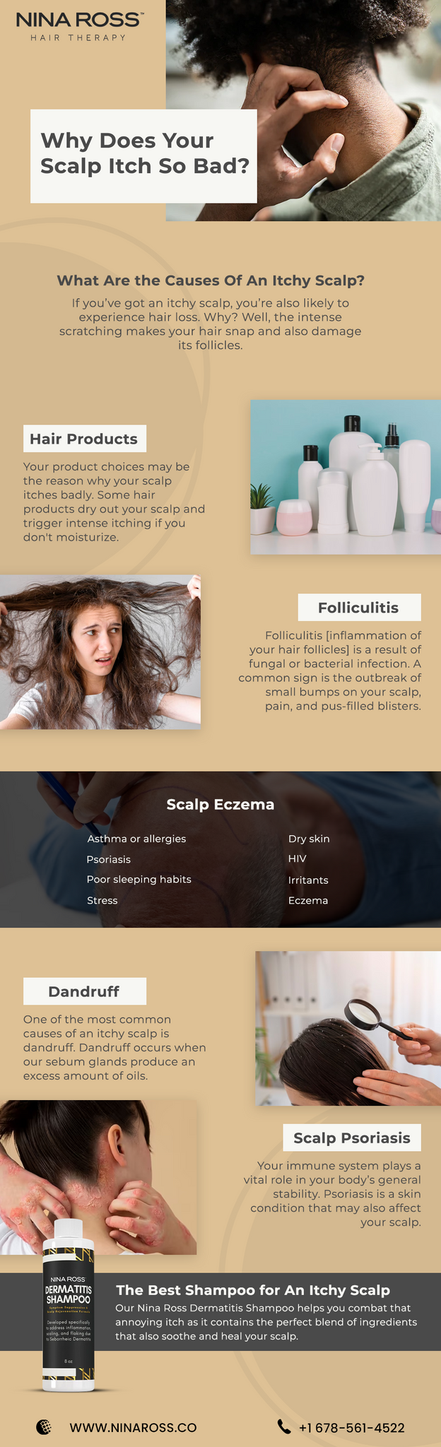 Itchy Scalp Causes