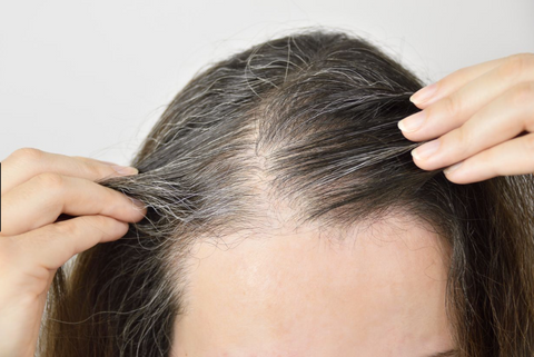 How to Reverse Telogen Effluvium & Grow Back Your Hair?