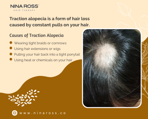 Causes of Traction Alopecia