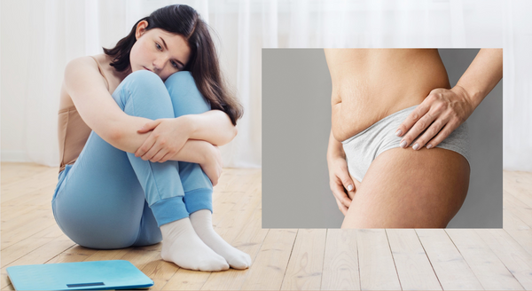 Blushinner-腹直肌分離嚴重性，穿收腹褲重要性