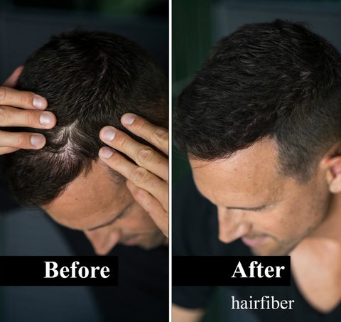 Mann mit Haarausfall kaschiert die Haare