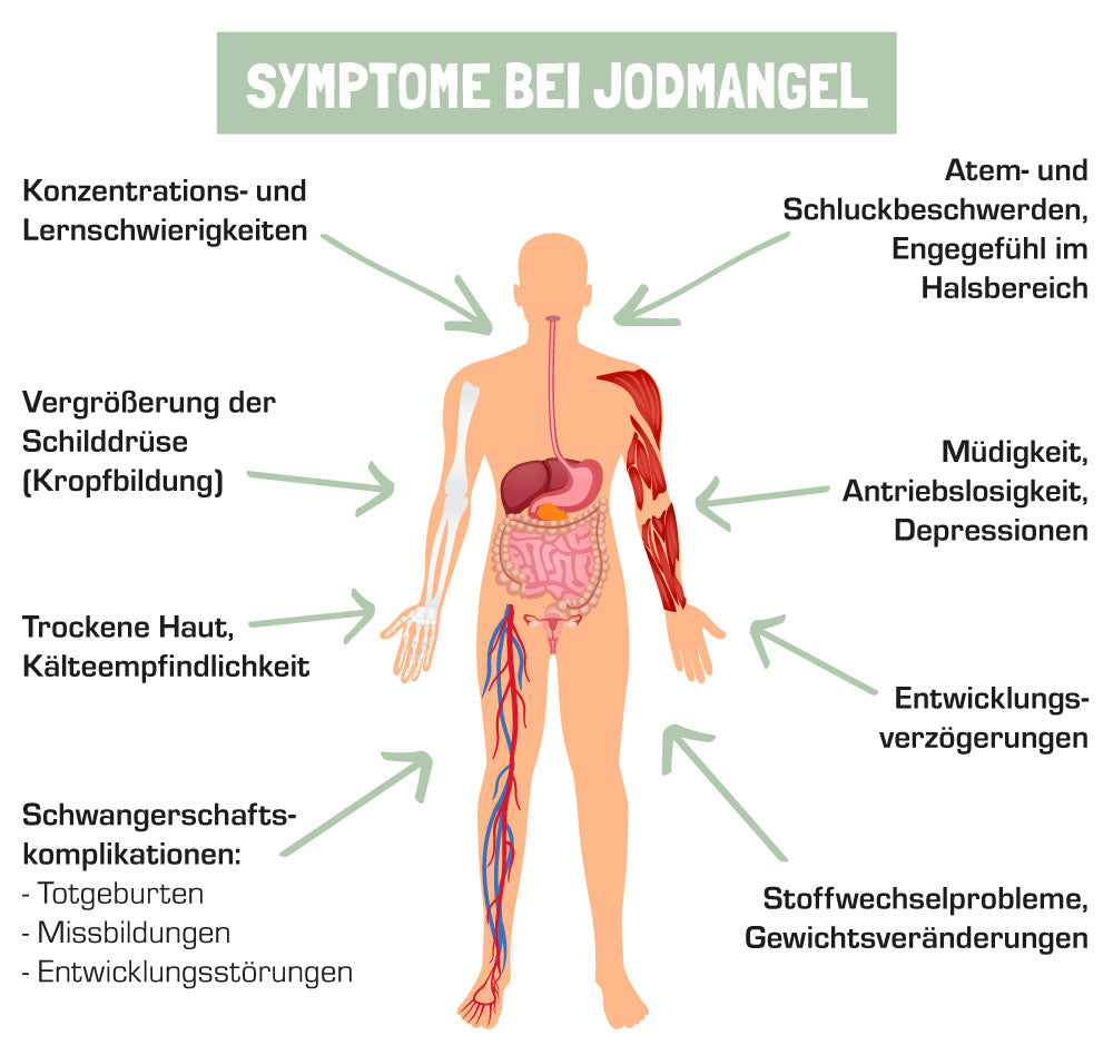 Symptome bei Jodmangel