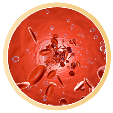 Oxidativer Stress