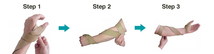 McKie Supination Strap & Thumb Splint Bundle (Adult Sizes) - McKie