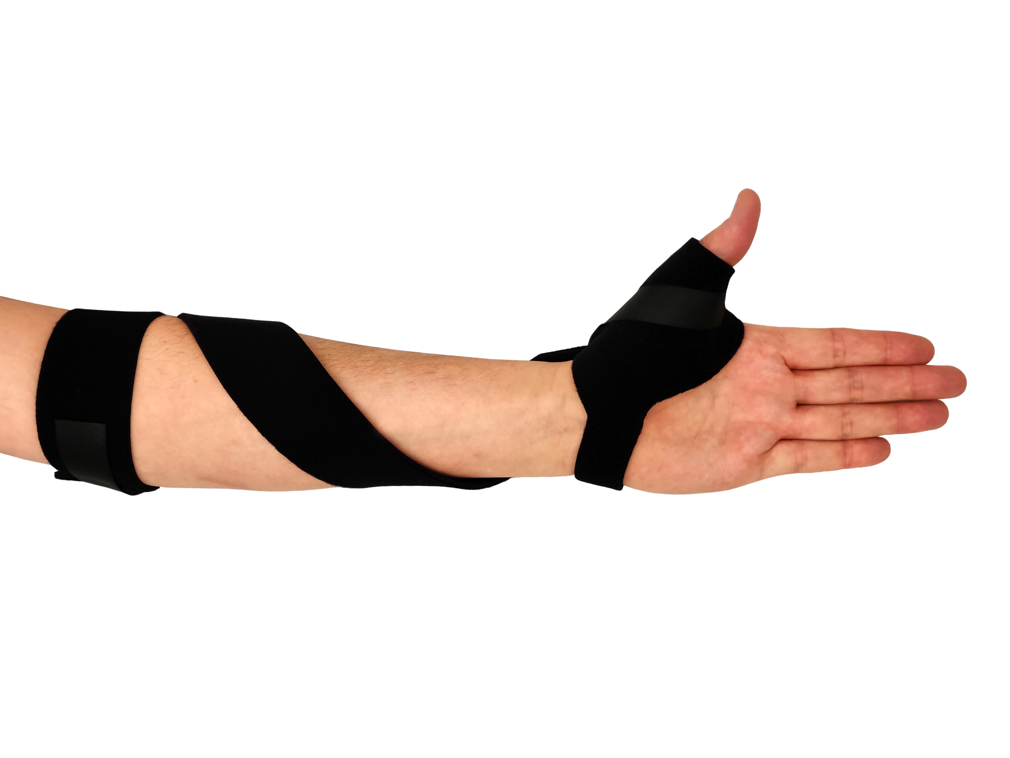 Supination/pronation of the forearm and hand occurs at which of