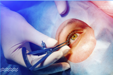 Imagen de una paciente a la que le están practicando una cirugía láser en los ojos.