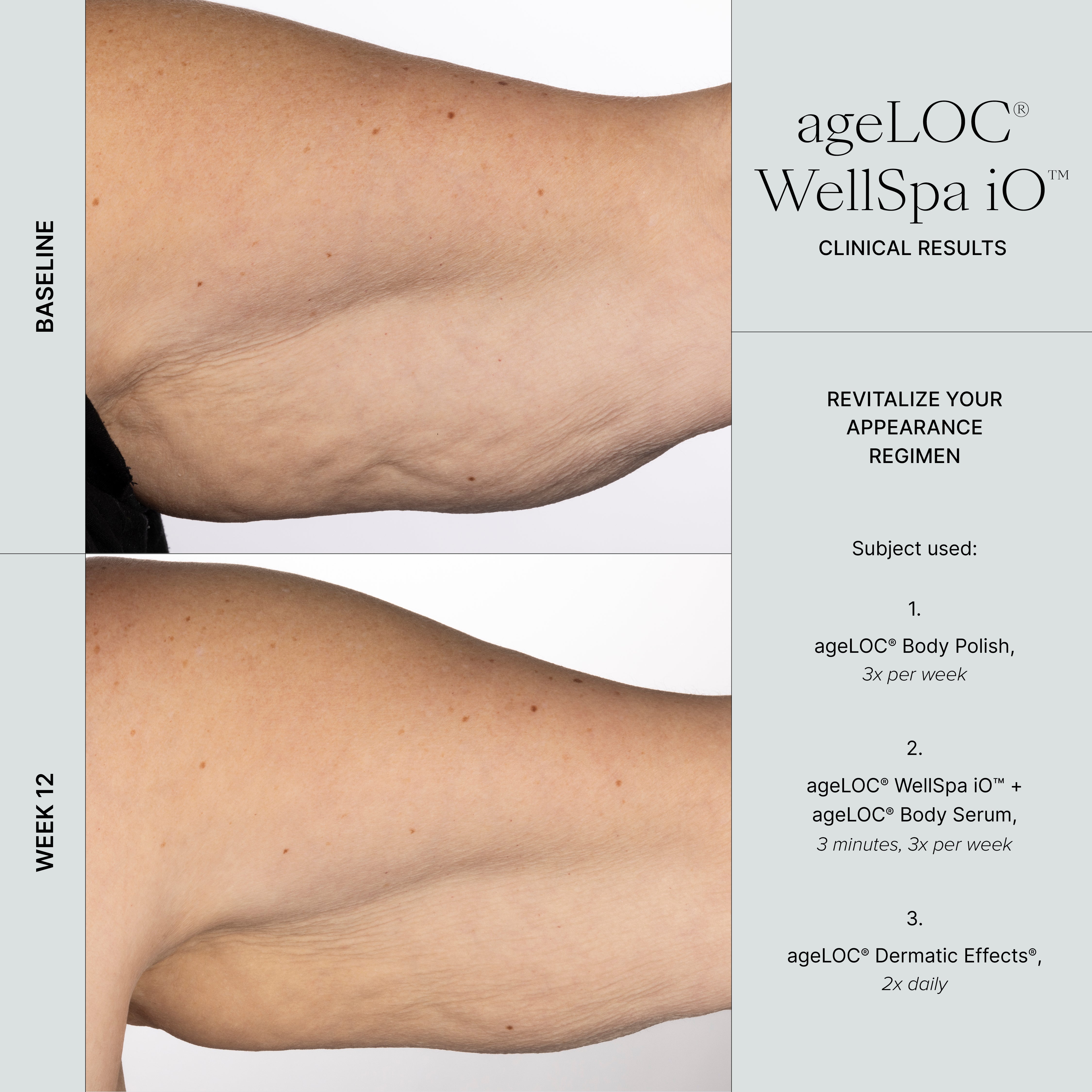WellSpa iO - under arm cellulite before and after