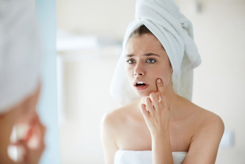 Skin Care Habits That Worsen Acne Acne Prone Skin – Bodyblendz