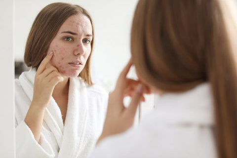 Understanding Maskne: Care and Prevention of Skin Irritations Caused b