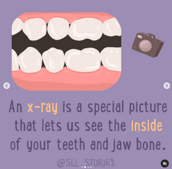 are dental x rays safe children oral health grin natural