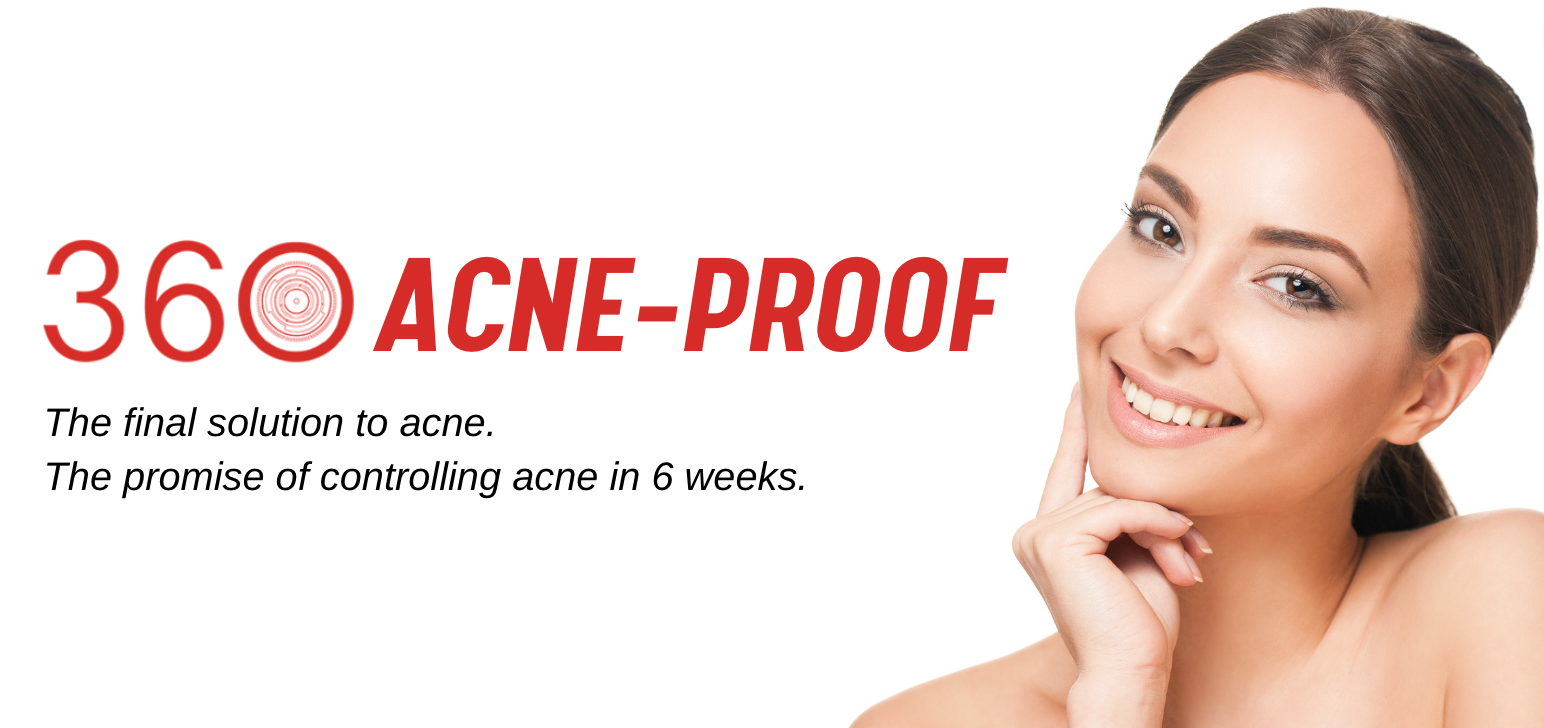 360 Acne-Proof Program for Acne 