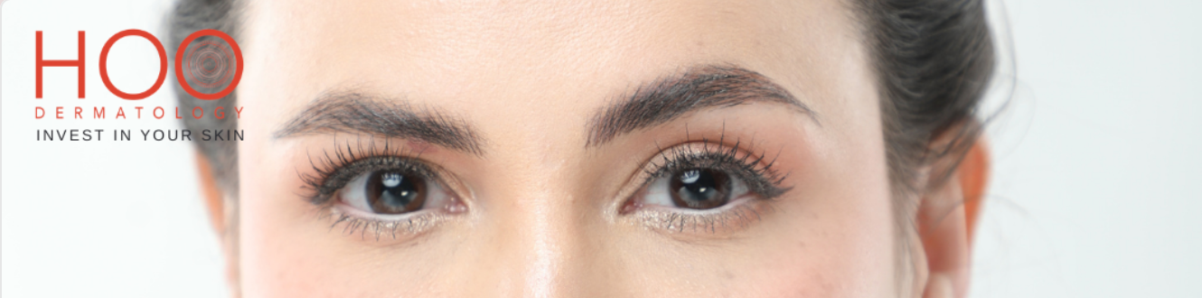 close up of eye area