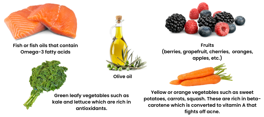 food groups to consume more of when you have acne 