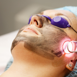 woman undergoing laser treatment on face