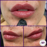 What is the best lip filler? No more mistakes with lip filler the secret of lip filler Buy the lips you’ve always dreamed of you deserve it lip injections Are a great way to make sure those lips look natural and realistic. Check out lip injections. Lip plumper. Get the lips you’ve always wanted before and after from real happy patients life is short buy the lips lip filler, lip injections, lip augmentation, lip plumper, lip plumping, lip enlargement, how do you get bigger lips, how to get fuller lips, how to make your lips bigger, how to get plump your lips, bee sting lips, the stone lips, smile re-design, Lip filler cost, Juvéderm, filler for lips, Juvéderm lips before and after photos, how to make a smile bigger, Botox lips, dermal filler 92336 inland empire nurse Mel NP aspire weight loss & wellness Fontana