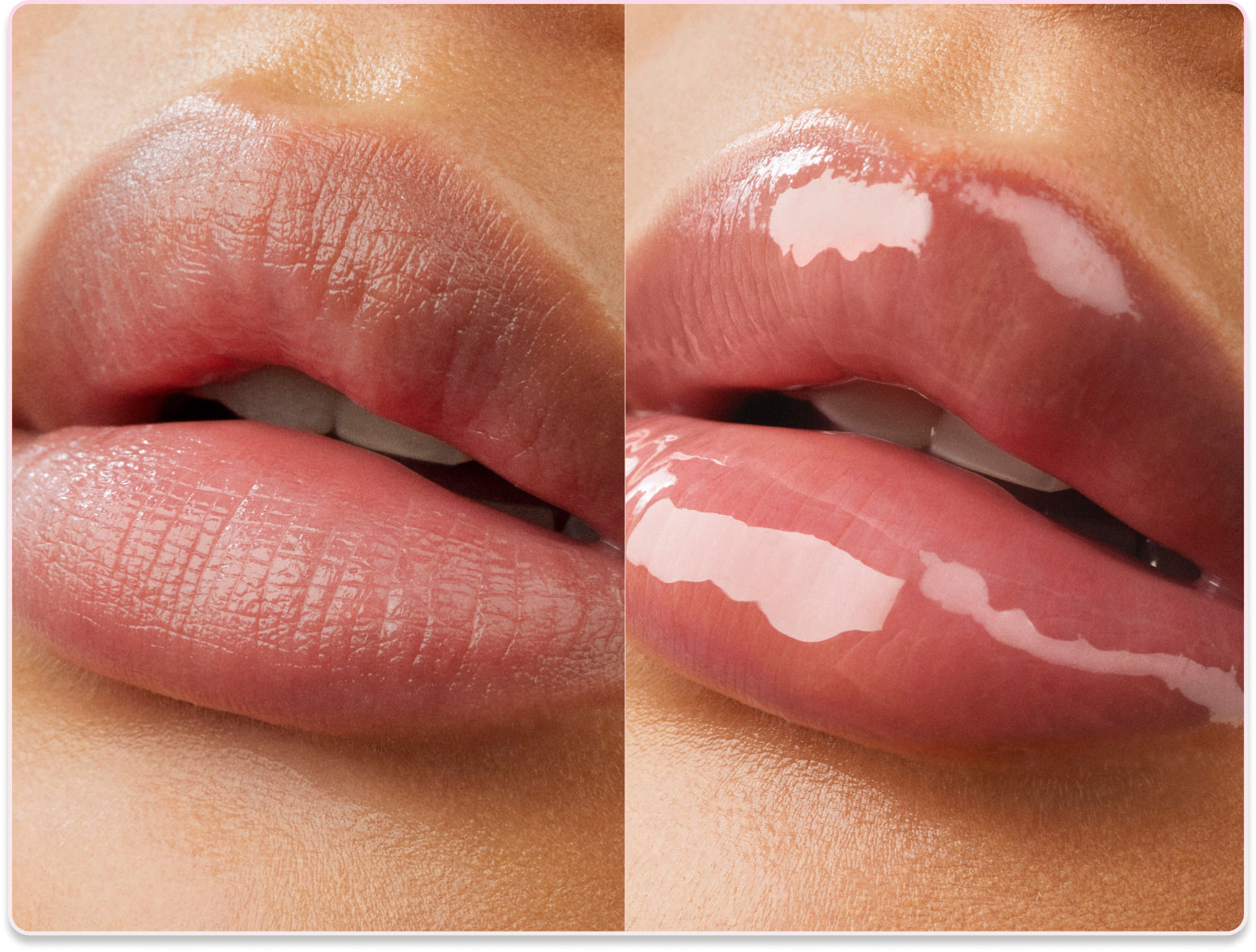 Best Lip Oil for Dry Lips