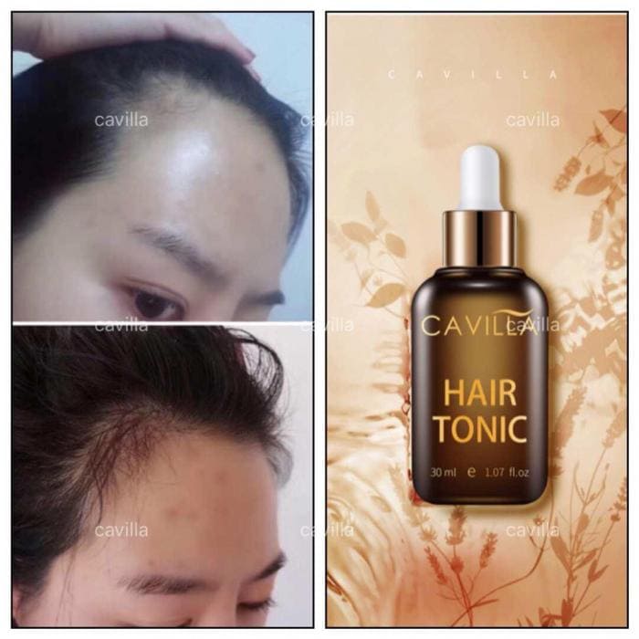 Cavilla Malaysia 3 Easy Way To Thicken My Hair Article 12