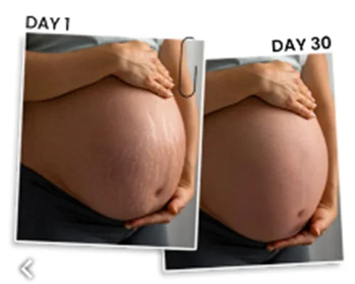Before and After Image