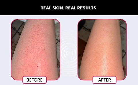 Bumps eraser2.webp__PID:5f93b863-1bbd-426b-b8eb-ed05d7419cee