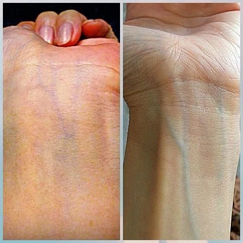 Look At Your Veins