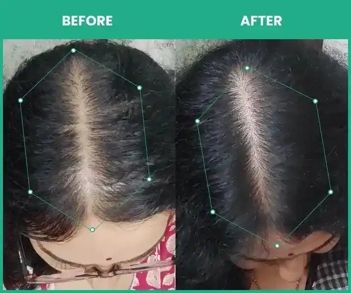results after using combo of rosemary essential oil and hair serum in women