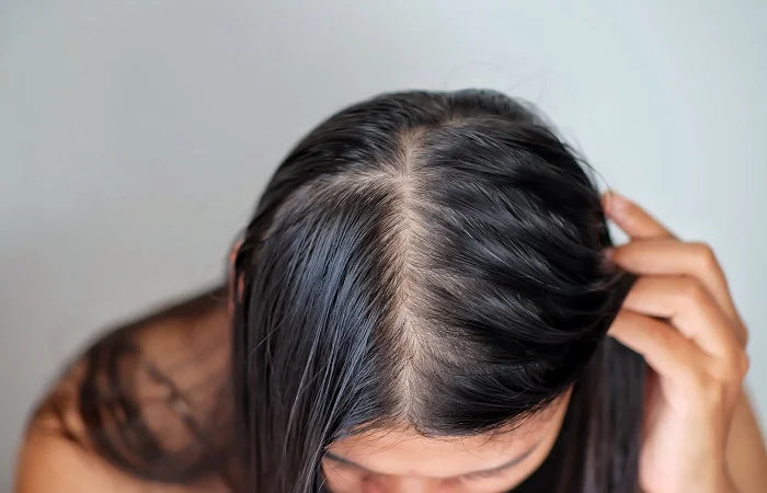 Scalp Issues