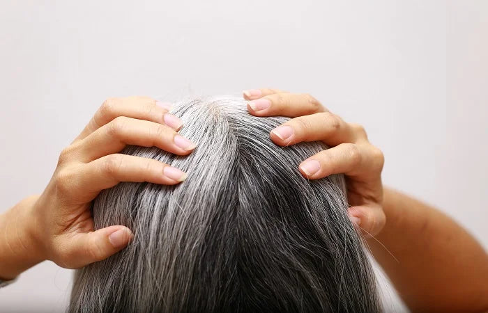 Causes of grey hair