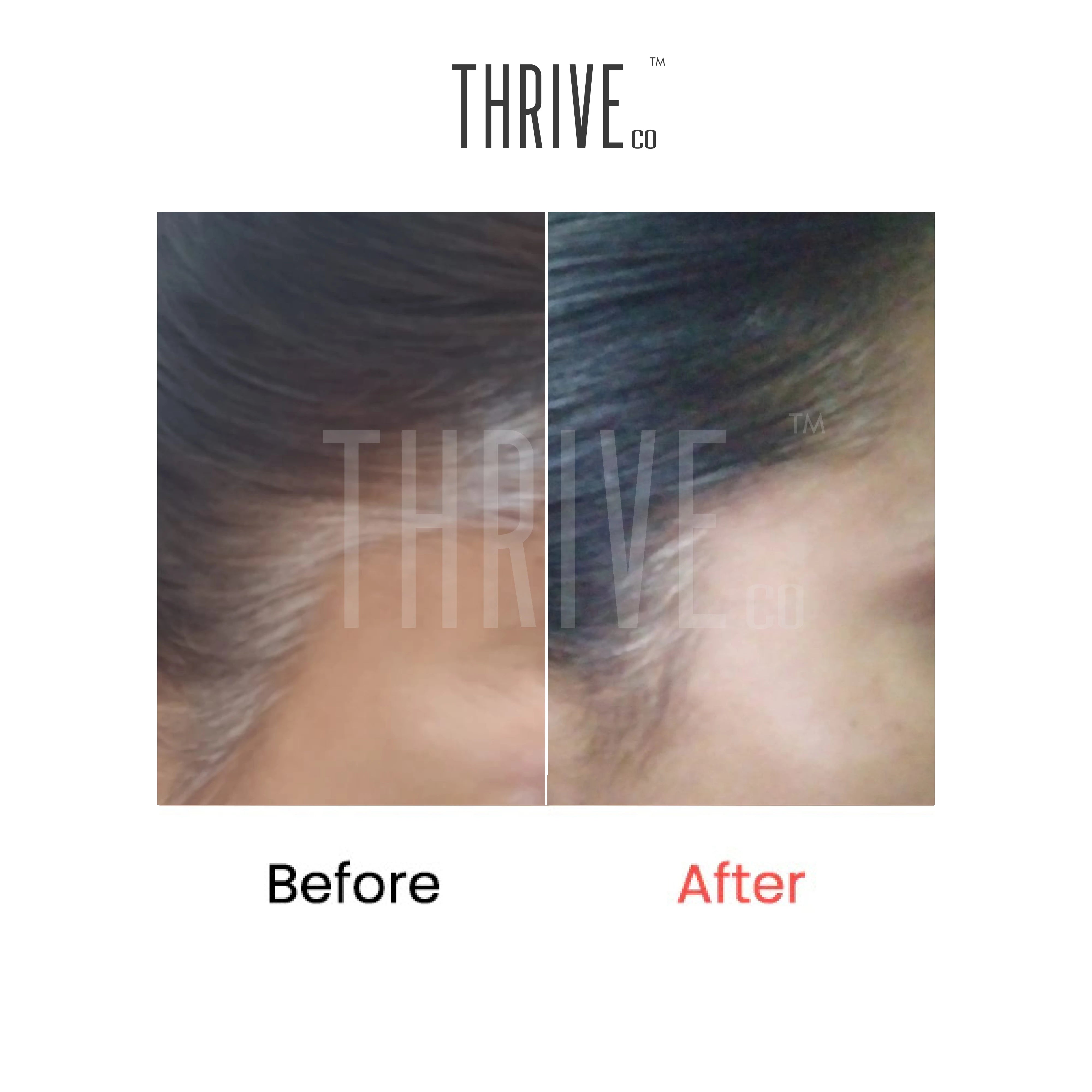 I Got ThriveCos Hair Prime Serum  My Fight With Grey Hair Days Are  Officially Over  Makeup Review And Beauty Blog