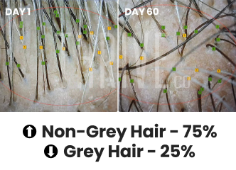 Reverse premature grey hair in 60 days
