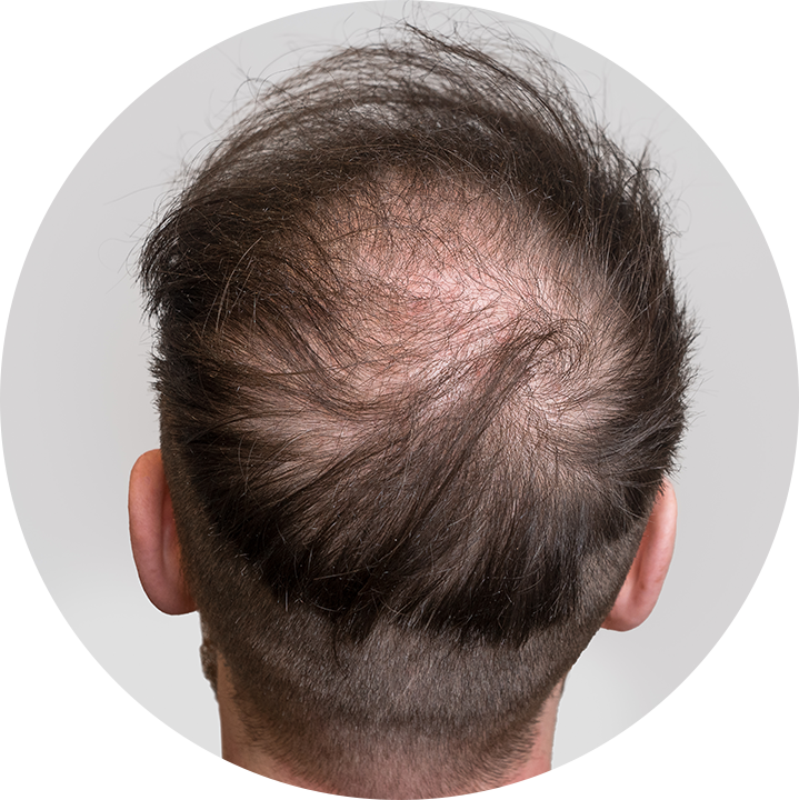 anti hair thinning serum for men