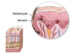 Melanin skin tanning after Melanotan injection