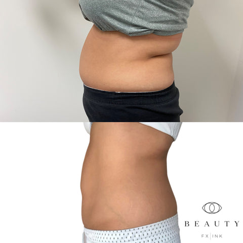 The Importance of Non-Invasive Belly Tightening After Pregnancy: A